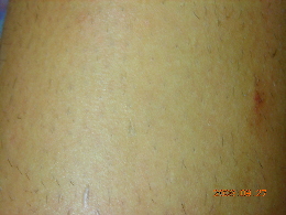 �u�p�C�i�b�v���������уN���[���v�̌���